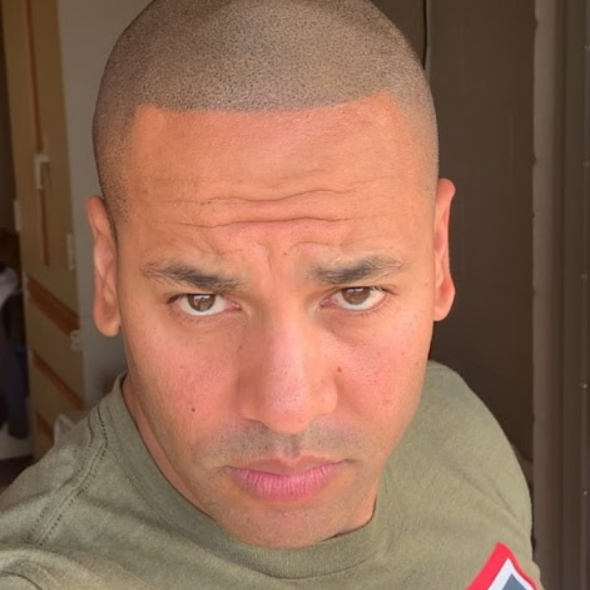 Non-surgical hair loss treatment using scalp micropigmentation in Omaha