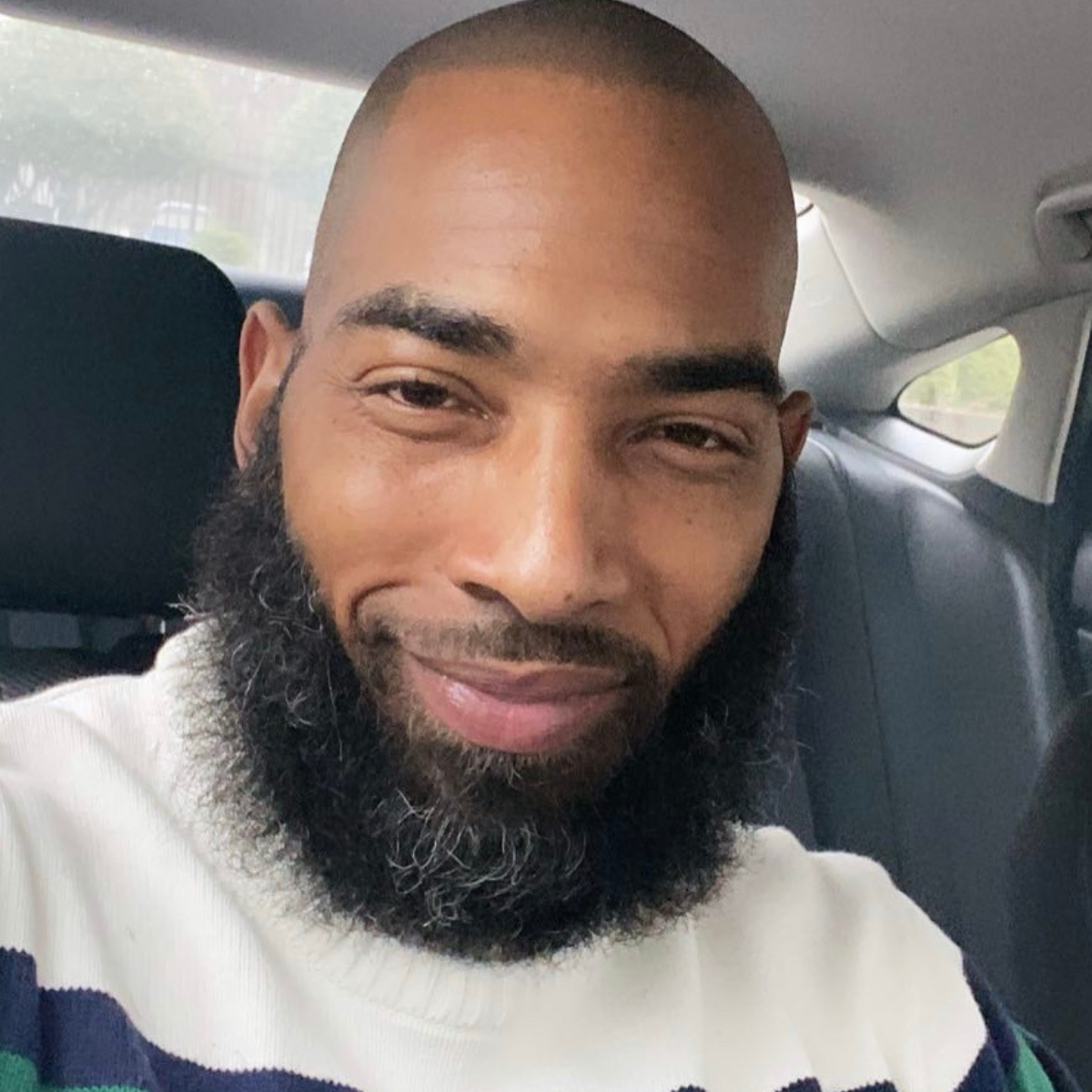 Scalp micropigmentation session being performed in Omaha Nebraska