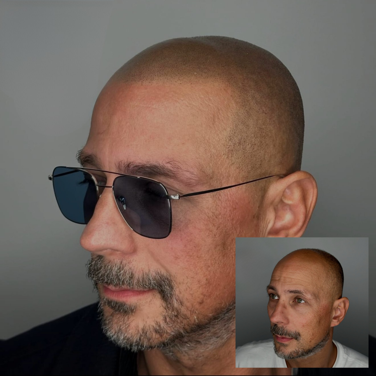 SMP hair tattoo results in Omaha NE