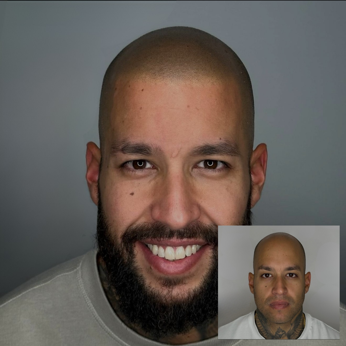 SMP Hair results in Omaha NE