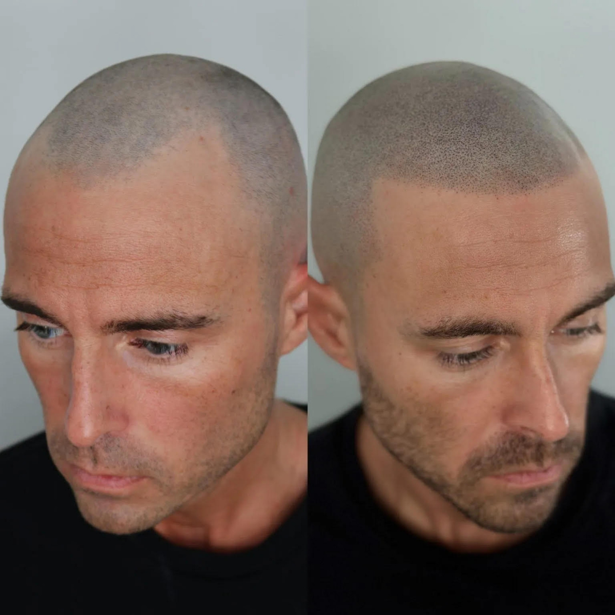 SMP Before vs After Omaha Nebraska